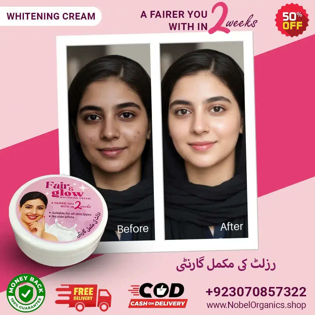 Advertisement for Nobel Organics Whitening Cream showing 'Before' and 'After' effects on a pink background.