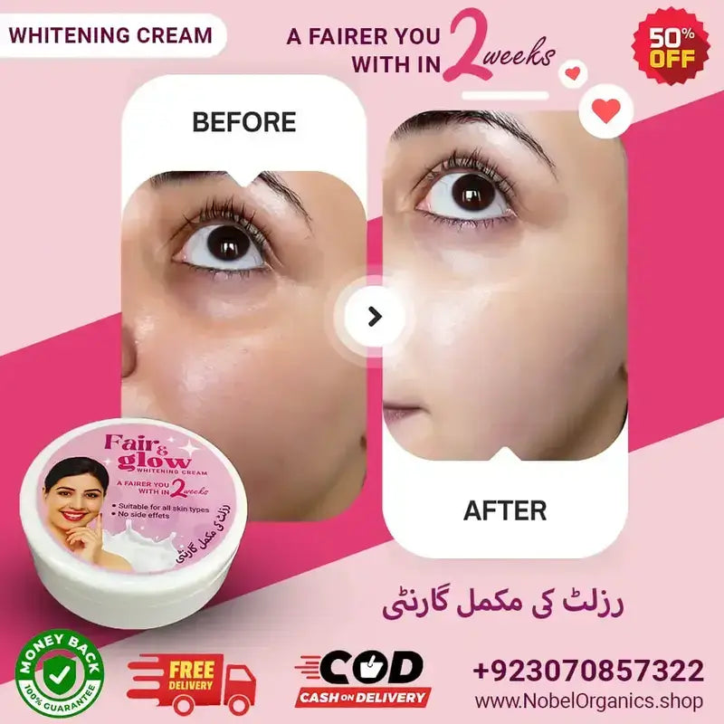Advertisement for Nobel Organics Whitening Cream showing before and after effects on a pink background.