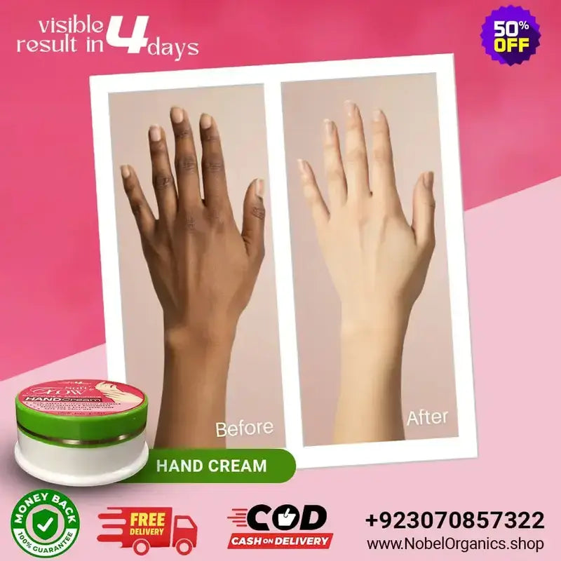 Hand cream advertisement showing before and after effects on hands with promotional text and contact information.